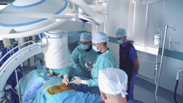 Teamarbeit Von Chirurgen Die Eine Operation Durchführen Operationssaal Mit Männlichen — Stockvideo