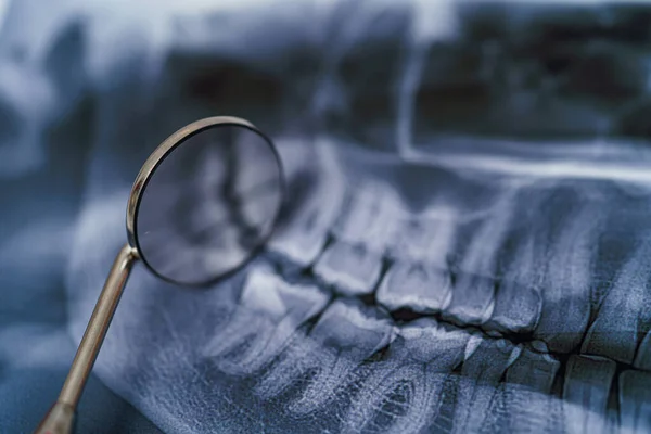 Panoramische Kaak Röntgenfoto Met Tandspiegel Tandheelkundige Behandeling Concept Sluitingsdatum — Stockfoto
