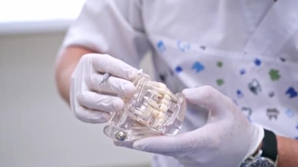 Médico Mostra Uma Amostra Mandíbula Plástico Modelar Diferentes Métodos Tratamento — Vídeo de Stock
