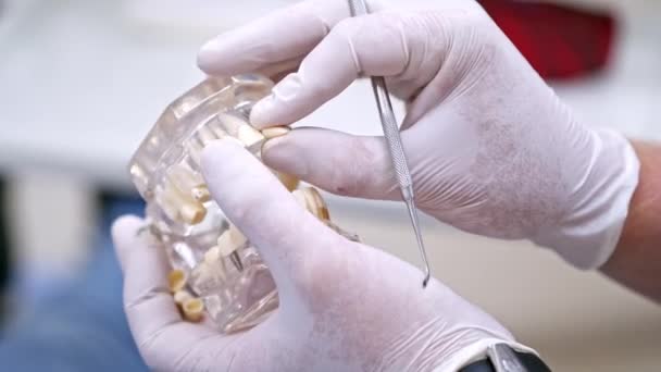 Händerna Håller Käkmodell Konstgjorda Tänder Stomatologens Händer Laboratorium För Tandimplantat — Stockvideo