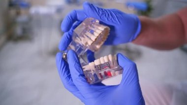Doktor plastik çene örneğinde ya da modelinde sahte implantlar gösteriyor. Modern diş sağlığı kliniği geçmişi. Doktorun ellerinde mavi tıbbi eldiven. Diş hijyeni ve sağlık konsepti videosu. Çeneye implantlar.