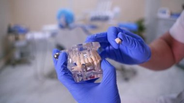 Doktor plastik çene örneğinde ya da modelinde sahte implantlar gösteriyor. Modern diş sağlığı kliniği geçmişi. Doktorun ellerinde mavi tıbbi eldiven. Diş hijyeni ve sağlık konsepti videosu. Çeneye implantlar.