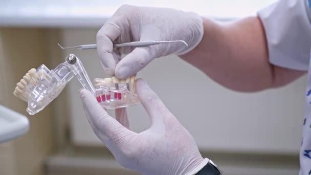 Крупним Планом Штучні Зуби Руках Стоматолог Білих Стерильних Рукавичках Показує — стокове відео