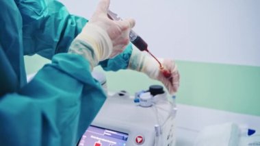 Kök hücre enjeksiyon prosedürü. Kadın işçi şırıngadan özel makineye kan döker. Klinikte modern ekipman.