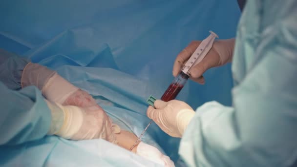 注射器和血液在医生手里 为病人注射干细胞的专家 后续行动 — 图库视频影像