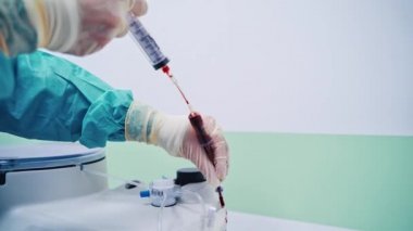 Kök hücrelerin laboratuvar araştırması. Trombosit zengini plazma hazırlığı. Şırıngada plazma.