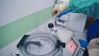 Kök hücre terapisi. Şırıngada plazma. Santrifüj.