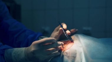 Oftalmoloji operasyonu. Eldivenli cerrahın elleri göz düzeltmesi yapıyor. Modern klinik ve ekipmanlar. Seçici video odağı.
