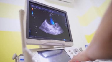 Modern ultrason makinesinin görüntüsü. Sağlık hizmetlerinde teşhis için tıbbi merkezdeki ultrason cihazının görüntüsü.