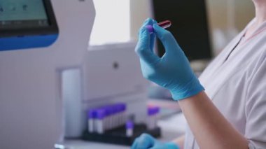 Laboratuvar çalışanının elinde bir şişe sıvı. Modern cihazlar üzerinde deneyler yapmadan önce kan örneklerini karıştıran bir tıp çalışanı. Yakın plan..