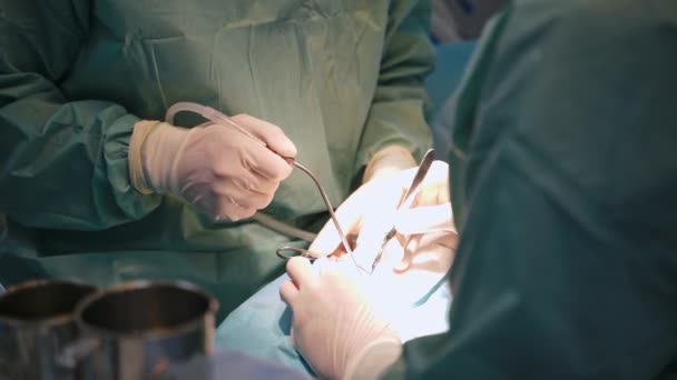 手術中に医師の手を閉じてください 外科医は手術の際に医療器具を使う 手術中の白い滅菌手袋の専門家 — ストック動画