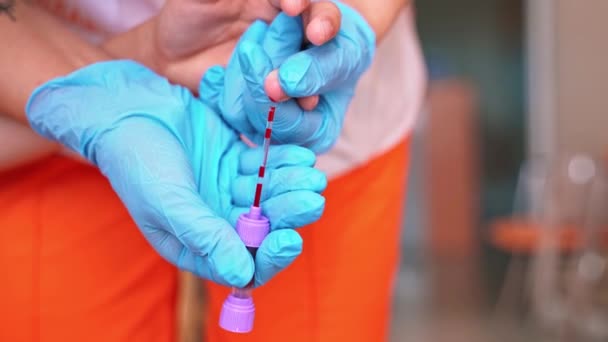 Las Manos Una Enfermera Cercana Recogen Sangre Asistente Médico Guantes — Vídeo de stock