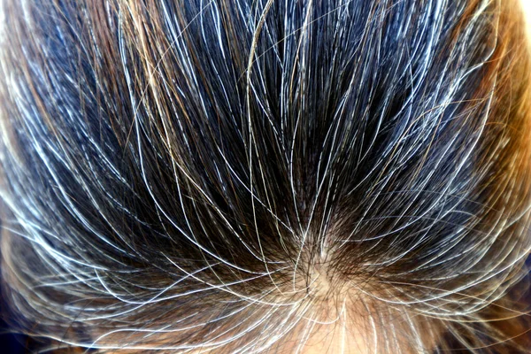 Foto Cerca Cabeza Una Mujer Con Cabello Castaño Negro Gris — Foto de Stock