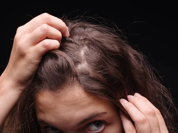 Mujer estresada con problemas de cabello sobre un fondo negro. Vitaminas para el cabello frágil. Concepto de tratamiento capilar. Copiar espacio . — Foto de Stock