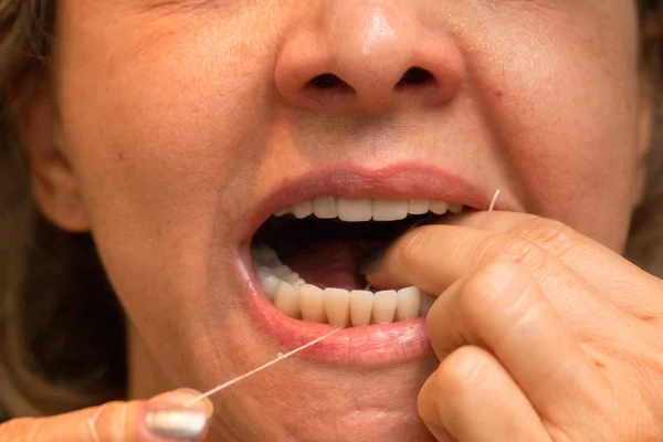 Mujer Flossing Sus Dientes Para Una Buena Higiene Dental — Foto de Stock