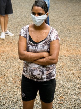 Planaltina, Goias, Brezilya-20 Mayıs 2020: Vitiligo hastalığı olan yüz maskesi takan bir kadın yerel bir beslenme merkezinde yemek kuyruğunda bekliyor