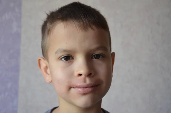 Fermer les lèvres et le visage d'un écolier ou d'un adolescent allergique. Irritation des lèvres. Portrait d'enfant souriant éternuant, nez égratigné, allergie saisonnière, maladie moderne — Photo