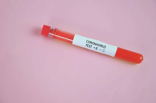 Yeni hızla yayılan Coronavirüs için pozitif kan testi sonucu Çin 'in Wuhan şehrinde ortaya çıktı.