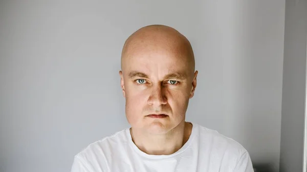 Man in white t-shirt suffers from toothache. — Stock Photo, Image