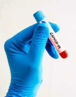 Mavi eldivenli bir sağlık çalışanı Coronavirus COVID-19 testi için üzerinde kan olan bir tüp tutuyor.