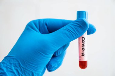 Mavi eldivenli bir hemşirenin elinde Coronavirus COVID-19 testi için kan örneği tüpü var.