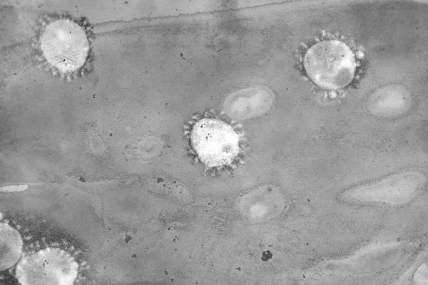 Ilustracion Del Coronavirus Traves Del Microscopio — Zdjęcie stockowe