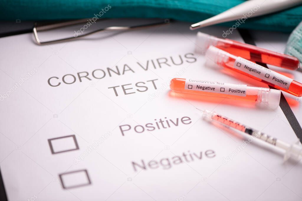 Middle East respiratory syndrome coronavirus test tube containing MERS-CoV close up