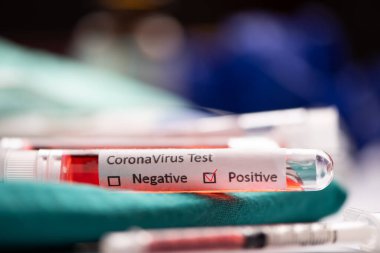 2019-Ncov. Coronavirus laboratuvarında Coronavirus kan testi