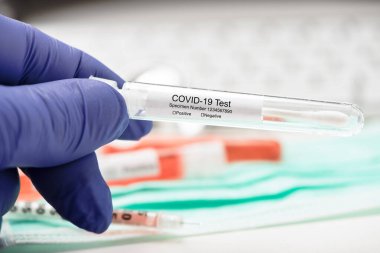 COVID-19 için kan testi. SARS-CoV-2 koronavirüsünün varlığı için kan örneği inceleniyor.