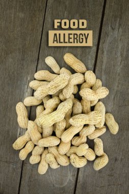 Yiyecek Alerji sağlık kavramı, fıstık veya yer fıstığı yakın kadar üzerinde woo