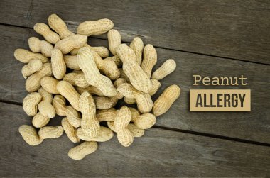 Yiyecek Alerji sağlık kavramı, fıstık veya yer fıstığı yakın kadar üzerinde woo