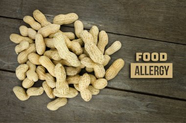 Yiyecek Alerji sağlık kavramı, fıstık veya yer fıstığı yakın kadar üzerinde woo