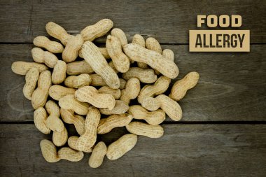 Yiyecek Alerji sağlık kavramı, fıstık veya yer fıstığı yakın kadar üzerinde woo