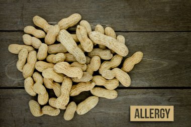 Yiyecek Alerji sağlık kavramı, fıstık veya yer fıstığı yakın kadar üzerinde woo