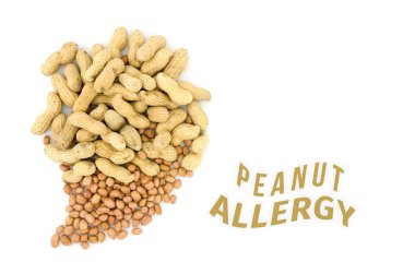 Fıstık veya yer fıstığı gıda Anti sağlık kavramı, görünümden tepe ı