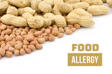 WHI üzerinde izole fıstık veya yer fıstığı gıda Anti sağlık kavramı,