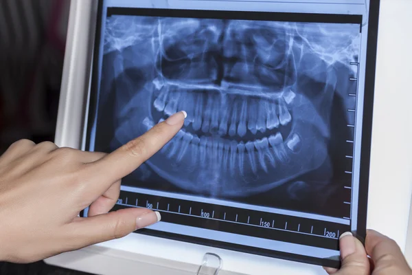 Проведение рентгеноскопии зубов — стоковое фото