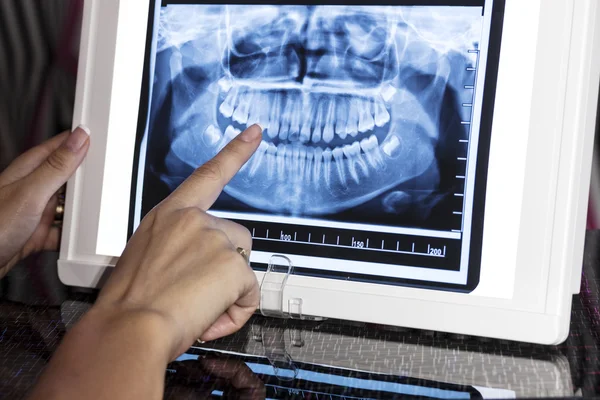 Radiografia panorâmica dentária — Fotografia de Stock