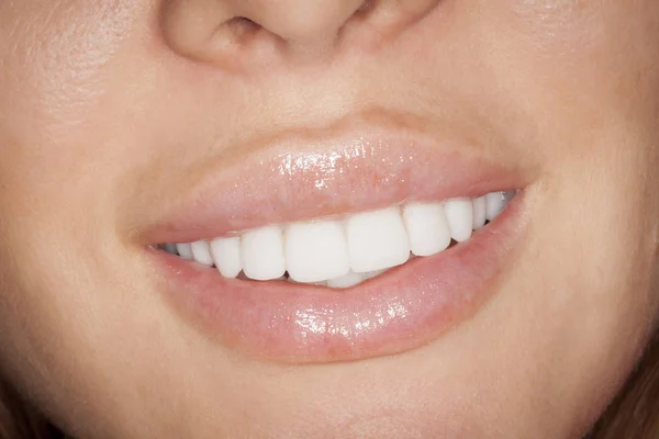 Sorriso largo branco — Fotografia de Stock