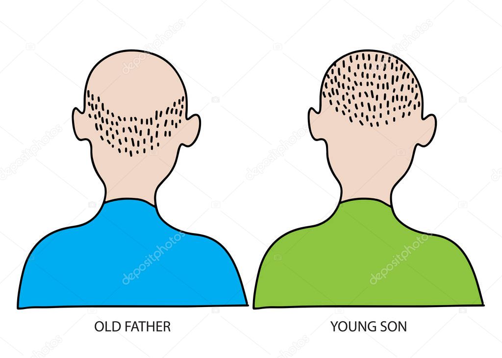 Old and young man. Hair lose and baldness concept. Father and son. Grandfather and grandson. Bald senior head.