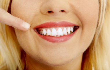 Beyaz dişler gösteriliyor.