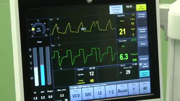 O trabalho de um monitor cardio na sala de cirurgia — Vídeo de Stock