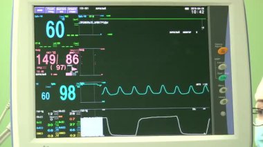 Ameliyathanedeki kardiyo monitörünün işi.