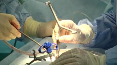 Ortopedi cerrahı ameliyathanede çalışıyor.