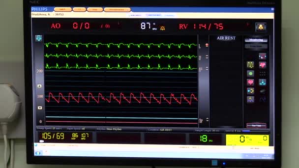 Praca monitora kardio na sali operacyjnej — Wideo stockowe