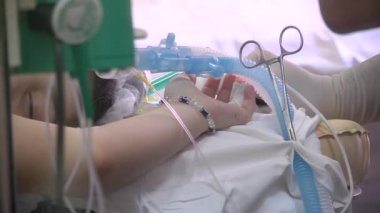 Hasta narkoz altında, ameliyat sırasında maskeyle nefes alıyor.
