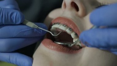 Sağlıklı dişler. Bir istemcisi yükleme bir diş hekimi, diş muayene sırasında kapatın