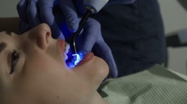 Diş hekimleri Doktor hastasına diş davranır. Diş hekimi fotopolimer mühür koyar