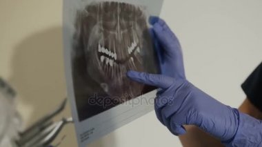 X-ışını diş dişçi elinde. Kadın dişçi genç bir adamın bir grafisi hasta diş gösterir