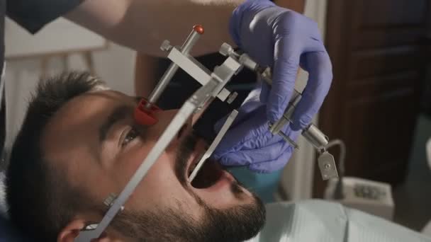 O dentista faz exame do arco da cara para conseguir um efeito cosmético mais bem sucedido para seu paciente — Vídeo de Stock